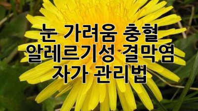 눈 가려움, 충혈? 알레르기성 결막염 자가 관리법